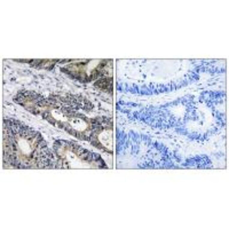 Immunohistochemistry - GLB1L3 Antibody from Signalway Antibody (34495) - Antibodies.com