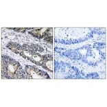 Immunohistochemistry - GLB1L3 Antibody from Signalway Antibody (34495) - Antibodies.com