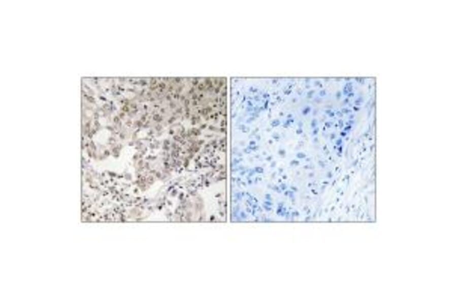 Immunohistochemistry - NCAPG2 Antibody from Signalway Antibody (34616) - Antibodies.com