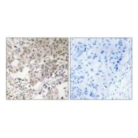 Immunohistochemistry - NCAPG2 Antibody from Signalway Antibody (34616) - Antibodies.com