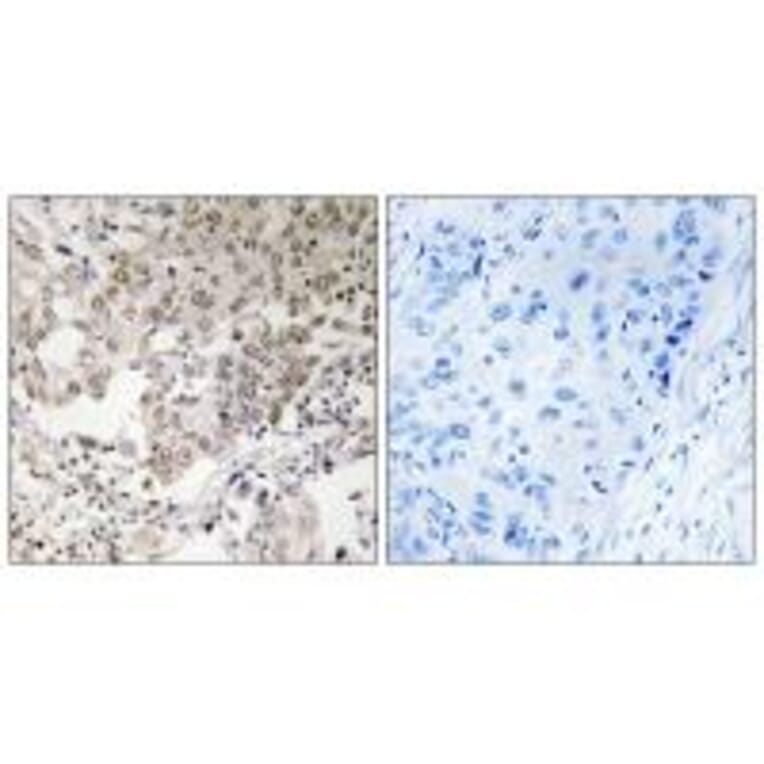 Immunohistochemistry - NCAPG2 Antibody from Signalway Antibody (34616) - Antibodies.com