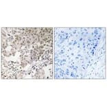 Immunohistochemistry - NCAPG2 Antibody from Signalway Antibody (34616) - Antibodies.com