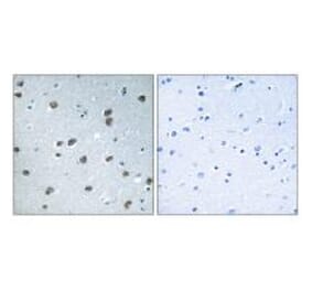 Immunohistochemistry - KLHL29 Antibody from Signalway Antibody (34751) - Antibodies.com