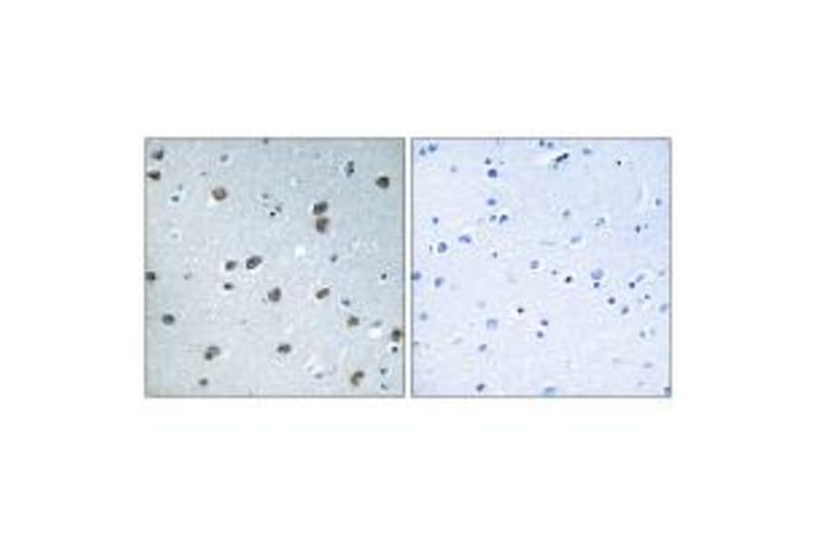 Immunohistochemistry - KLHL29 Antibody from Signalway Antibody (34751) - Antibodies.com