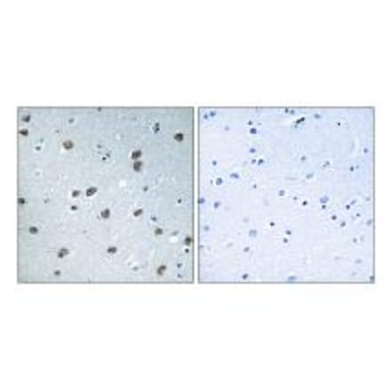 Immunohistochemistry - KLHL29 Antibody from Signalway Antibody (34751) - Antibodies.com
