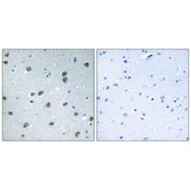 Immunohistochemistry - KLHL29 Antibody from Signalway Antibody (34751) - Antibodies.com