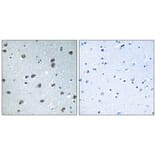 Immunohistochemistry - KLHL29 Antibody from Signalway Antibody (34751) - Antibodies.com