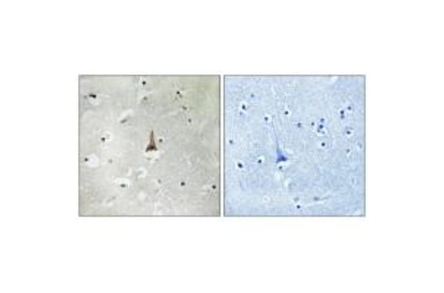 Immunohistochemistry - LRP10 Antibody from Signalway Antibody (34766) - Antibodies.com