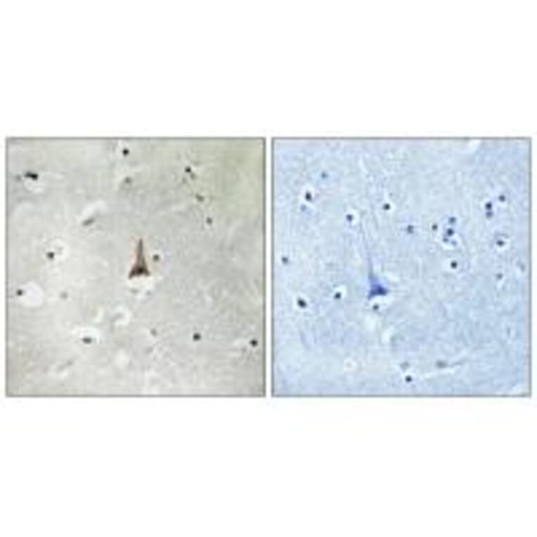 Immunohistochemistry - LRP10 Antibody from Signalway Antibody (34766) - Antibodies.com