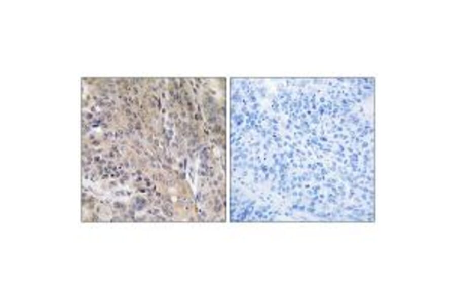 Immunohistochemistry - LAMP3 Antibody from Signalway Antibody (34772) - Antibodies.com