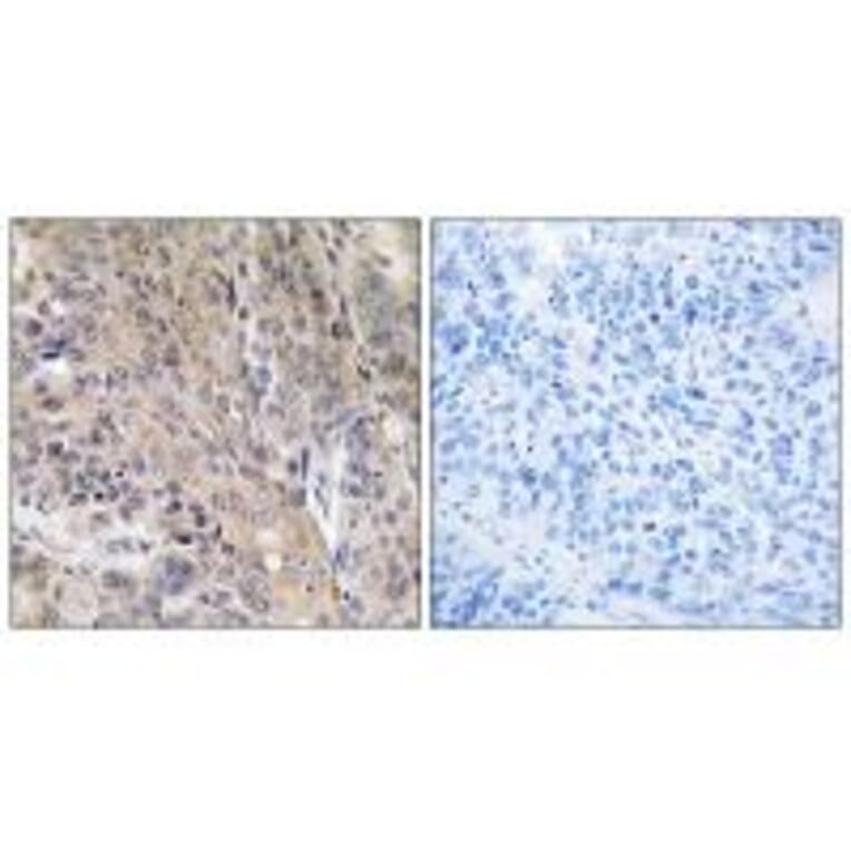 Immunohistochemistry - LAMP3 Antibody from Signalway Antibody (34772) - Antibodies.com