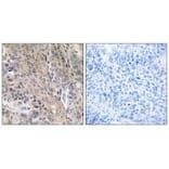 Immunohistochemistry - LAMP3 Antibody from Signalway Antibody (34772) - Antibodies.com