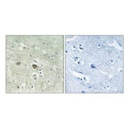 Immunohistochemistry - NDUFV3 Antibody from Signalway Antibody (34834) - Antibodies.com