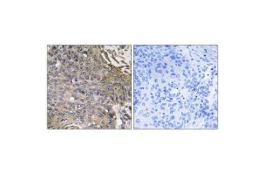 Immunohistochemistry - SH2D1B Antibody from Signalway Antibody (35040) - Antibodies.com