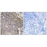 Immunohistochemistry - SH2D1B Antibody from Signalway Antibody (35040) - Antibodies.com
