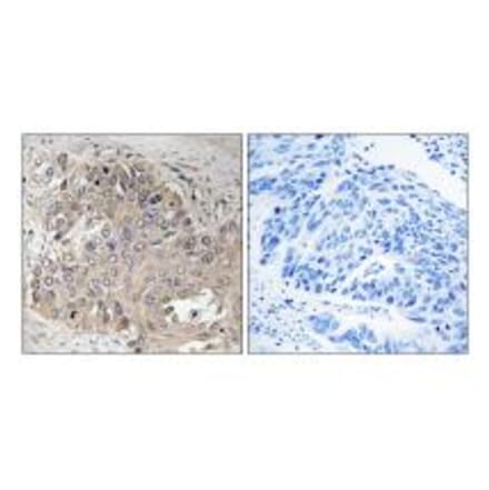 Immunohistochemistry - SPTBN5 Antibody from Signalway Antibody (35072) - Antibodies.com