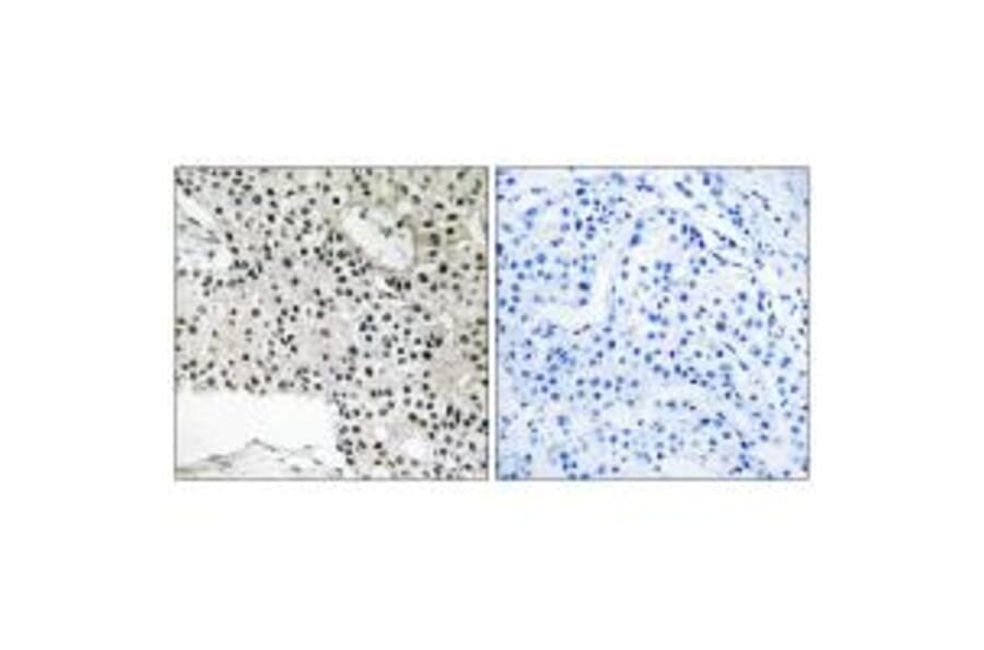 Immunohistochemistry - TCEAL4 Antibody from Signalway Antibody (35101) - Antibodies.com