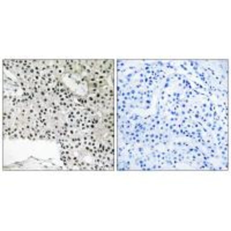 Immunohistochemistry - TCEAL4 Antibody from Signalway Antibody (35101) - Antibodies.com