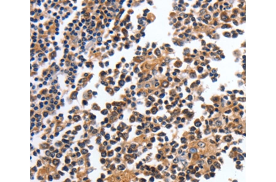 Immunohistochemistry - MAGEA4 Antibody from Signalway Antibody (35550) - Antibodies.com