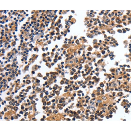 Immunohistochemistry - MAGEA4 Antibody from Signalway Antibody (35550) - Antibodies.com