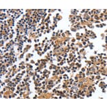 Immunohistochemistry - MAGEA4 Antibody from Signalway Antibody (35550) - Antibodies.com