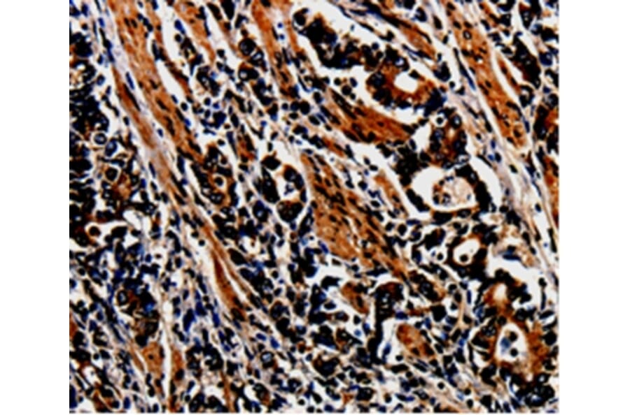 Immunohistochemistry - MAGEA4 Antibody from Signalway Antibody (35550) - Antibodies.com