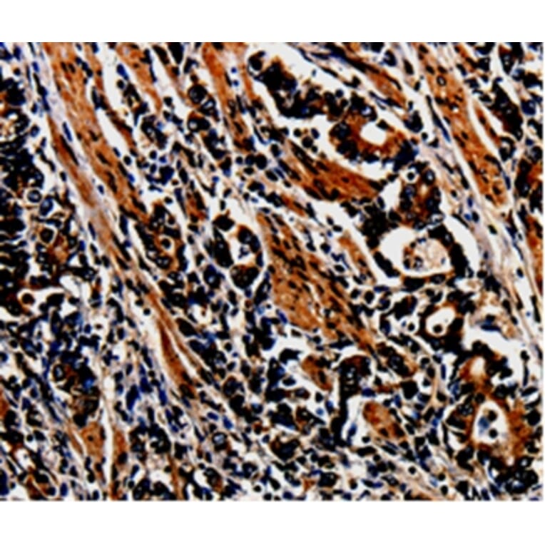 Immunohistochemistry - MAGEA4 Antibody from Signalway Antibody (35550) - Antibodies.com