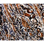 Immunohistochemistry - MAGEA4 Antibody from Signalway Antibody (35550) - Antibodies.com