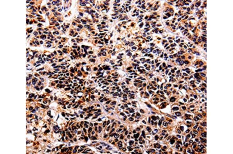 Immunohistochemistry - IL10RA Antibody from Signalway Antibody (35598) - Antibodies.com