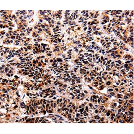 Immunohistochemistry - IL10RA Antibody from Signalway Antibody (35598) - Antibodies.com