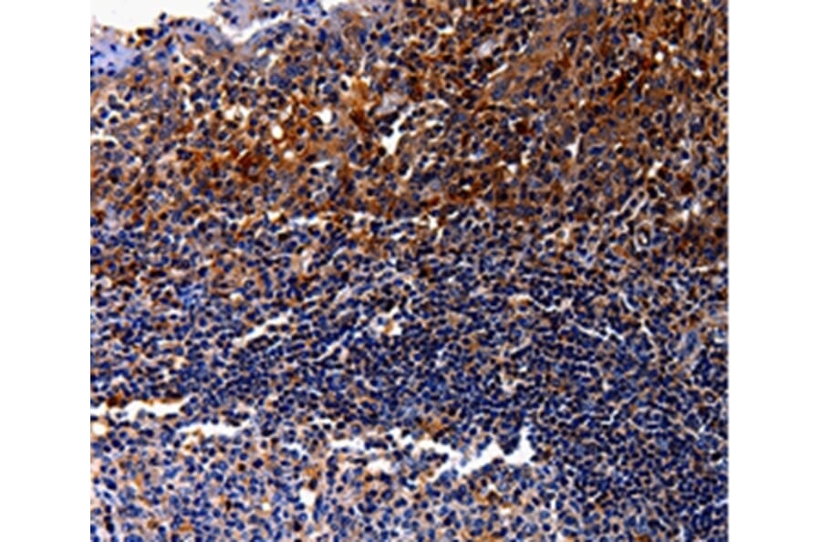 Immunohistochemistry - IL10RA Antibody from Signalway Antibody (35598) - Antibodies.com