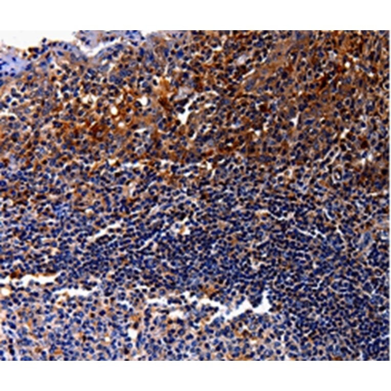 Immunohistochemistry - IL10RA Antibody from Signalway Antibody (35598) - Antibodies.com