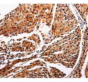 Immunohistochemistry - IL10RB Antibody from Signalway Antibody (35599) - Antibodies.com