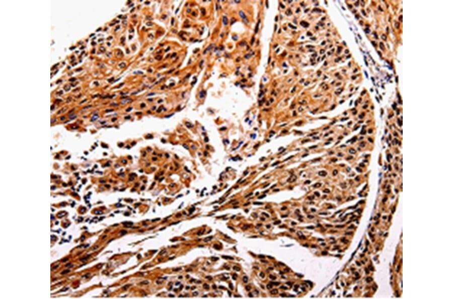 Immunohistochemistry - IL10RB Antibody from Signalway Antibody (35599) - Antibodies.com