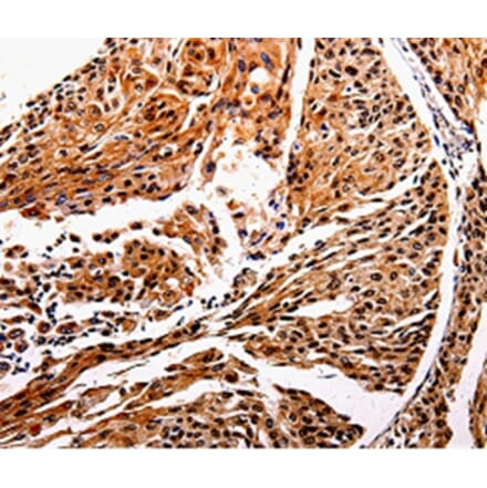 Immunohistochemistry - IL10RB Antibody from Signalway Antibody (35599) - Antibodies.com