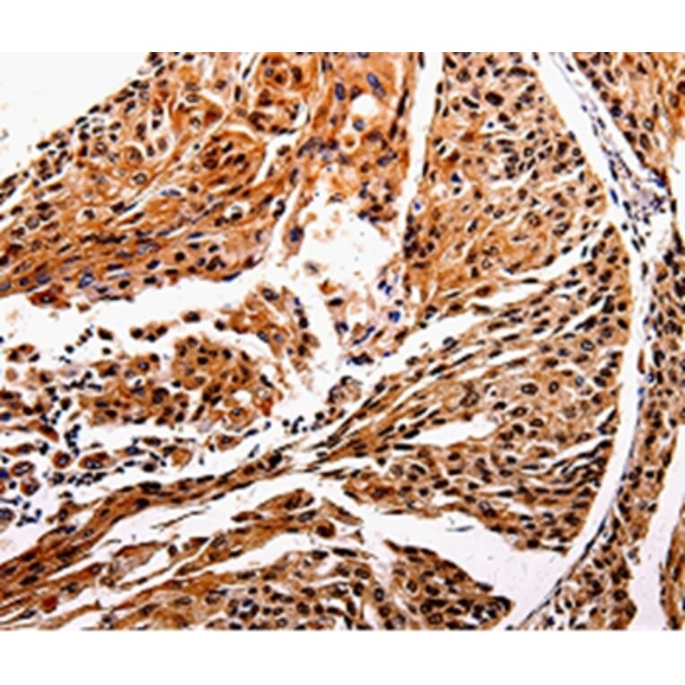 Immunohistochemistry - IL10RB Antibody from Signalway Antibody (35599) - Antibodies.com