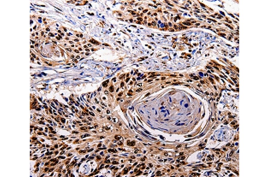 Immunohistochemistry - IL10RB Antibody from Signalway Antibody (35599) - Antibodies.com