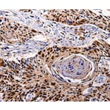 Immunohistochemistry - IL10RB Antibody from Signalway Antibody (35599) - Antibodies.com