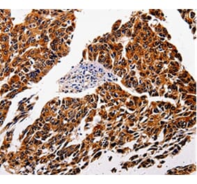 Immunohistochemistry - IL1RAP Antibody from Signalway Antibody (35605) - Antibodies.com