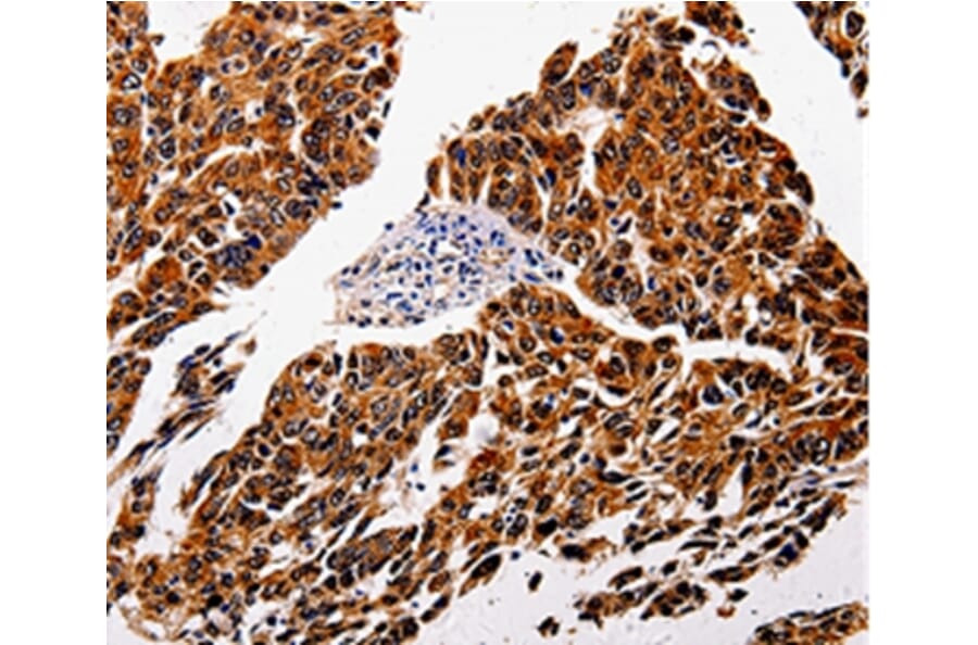 Immunohistochemistry - IL1RAP Antibody from Signalway Antibody (35605) - Antibodies.com