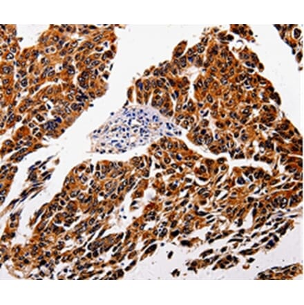 Immunohistochemistry - IL1RAP Antibody from Signalway Antibody (35605) - Antibodies.com