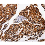 Immunohistochemistry - IL1RAP Antibody from Signalway Antibody (35605) - Antibodies.com