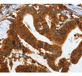 Immunohistochemistry - IL20RA Antibody from Signalway Antibody (35606) - Antibodies.com