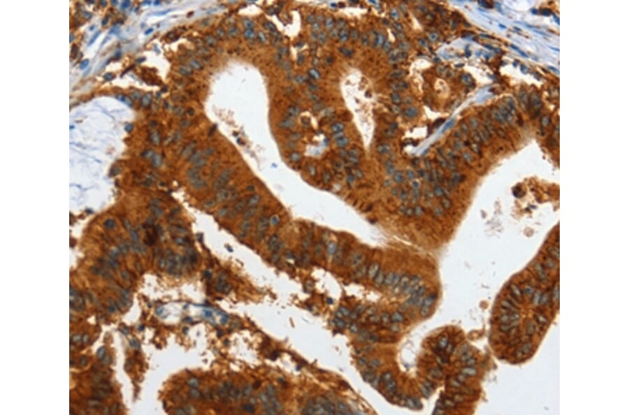 Immunohistochemistry - IL20RA Antibody from Signalway Antibody (35606) - Antibodies.com