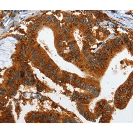 Immunohistochemistry - IL20RA Antibody from Signalway Antibody (35606) - Antibodies.com