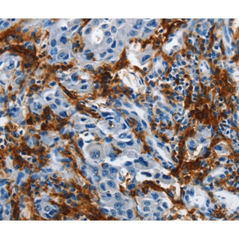 Immunohistochemistry - IL20RA Antibody from Signalway Antibody (35606) - Antibodies.com