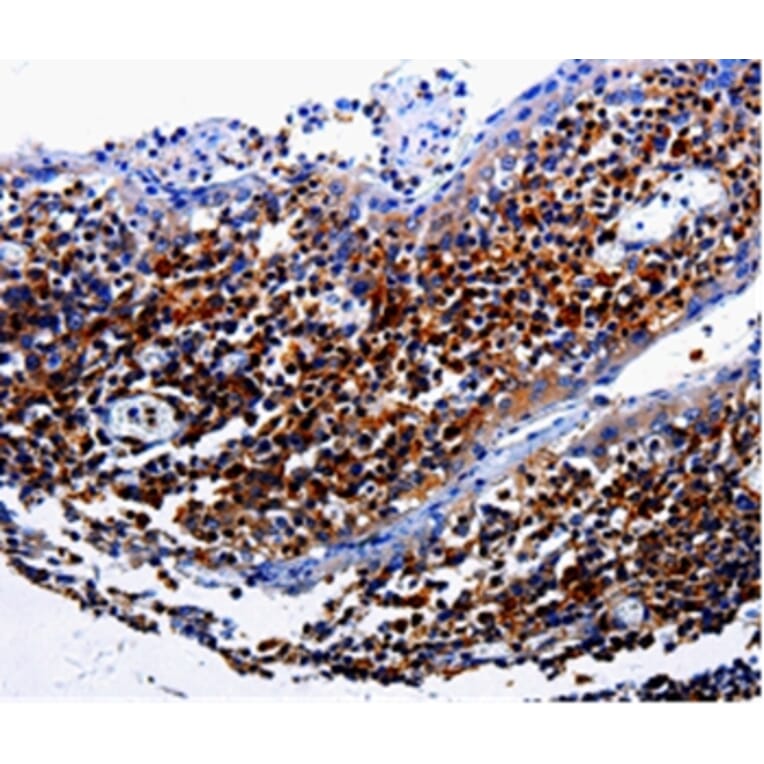 Immunohistochemistry - IL31RA Antibody from Signalway Antibody (35609) - Antibodies.com