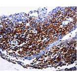 Immunohistochemistry - IL31RA Antibody from Signalway Antibody (35609) - Antibodies.com