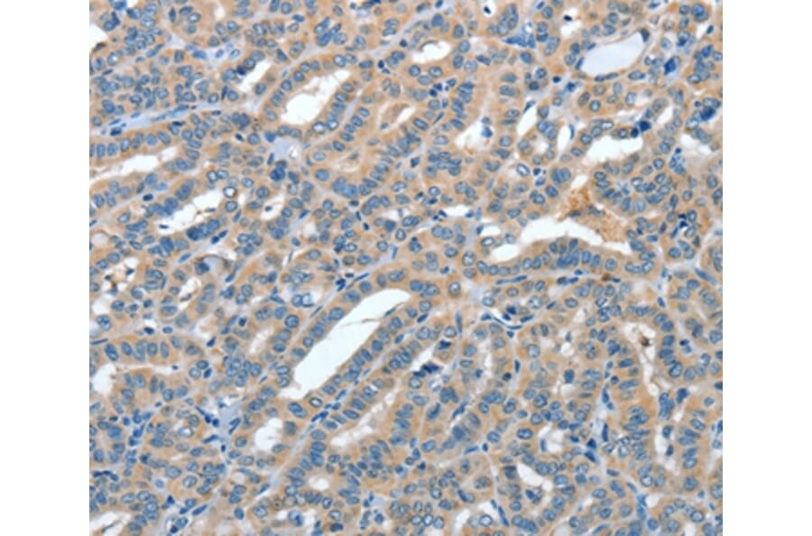 Immunohistochemistry - ANGPT1 Antibody from Signalway Antibody (35618) - Antibodies.com