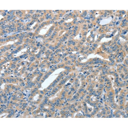 Immunohistochemistry - ANGPT1 Antibody from Signalway Antibody (35618) - Antibodies.com